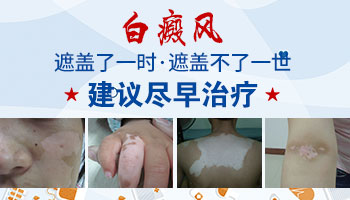 手上芝麻大的白斑是什么