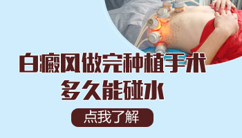 白癜风做完黑色素种植多长时间能洗脸