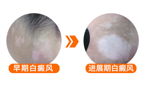 嘴角有一小块特别小的白斑是什么