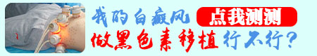 白癜风移植的价格是多少