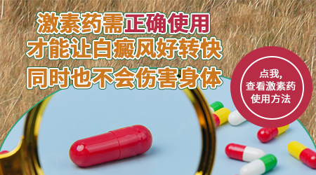 什么药能控制白斑不再发展