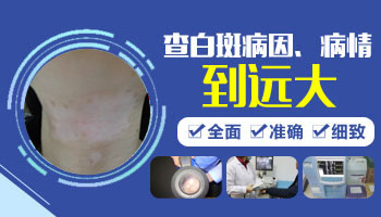 白癜风验血可以查诱因吗