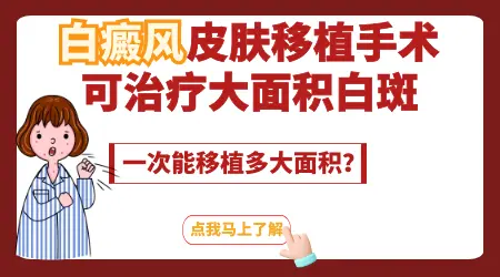 腿上白癜风种植手术要做几次