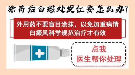 白癜风用外用药后发红起泡正常吗