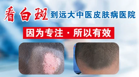 邢台哪些医院专门治白癜风