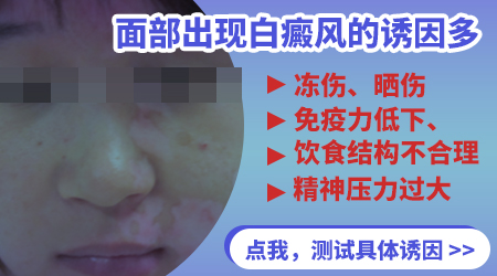 山西儿童白斑是什么病因造成的