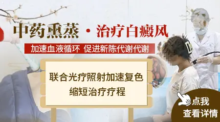 熏蒸治疗白癜风作用大吗