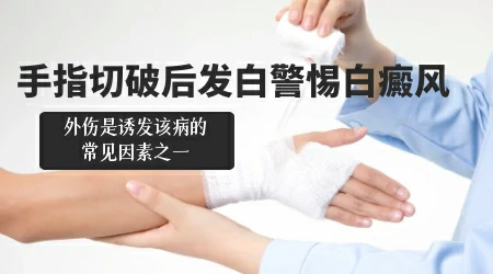 手指上有白点是什么原因造成的