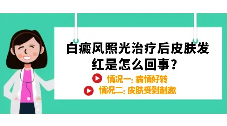 308激光照完白癜风皮肤发红是剂量太大了吗