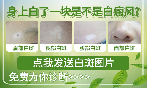 浅白色很明显的白斑是不是白癜风