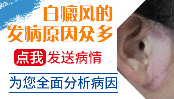 宝宝耳朵边上很大一块白斑是什么原因