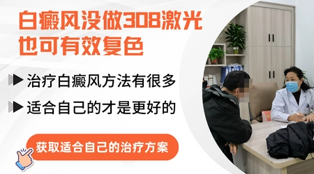 白癜风没做308激光也可有效复色
