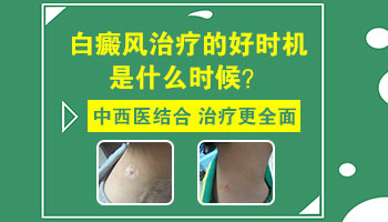 白癜风什么时候做种植手术好