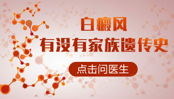 白癜风是不是家族遗传 长白斑是为什么