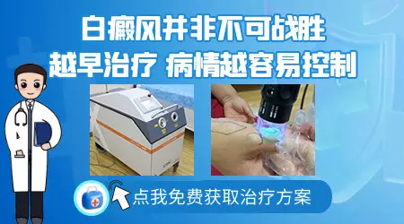 白癜风容易治好吗