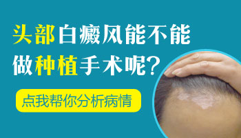 白斑长在头部能不能做种植