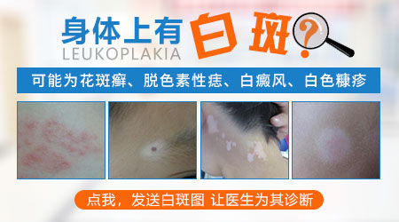 身上起了一块一块白色