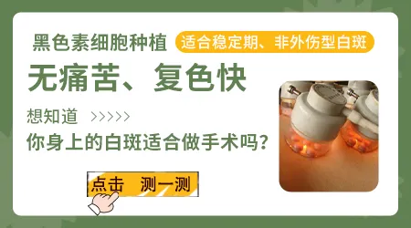 手足部位的白癜风手术成功率如何