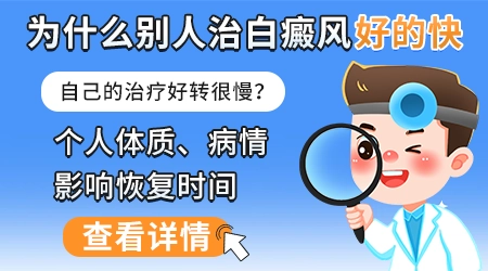 刚发病的白癜风涂药膏还需要吃口服药吗