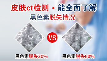 白斑做一次三维皮肤ct多少钱