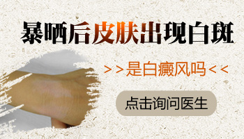 暴晒后皮肤出现白斑怎么祛除