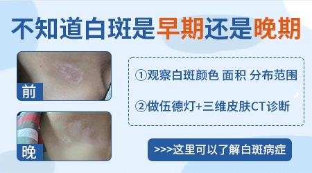 背部白斑的早期症状