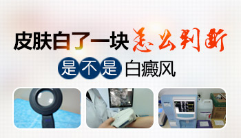 小孩脸上白了一块是怎么回事