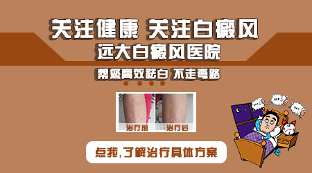 嘴角白癜风涂药后有点脱皮还能继续做光疗吗