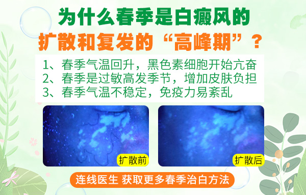 伍德灯下的各种白斑图片