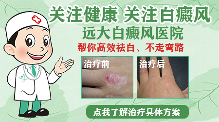 为何青少年更容易患上白癜风