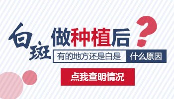 白癜风移植六个月还有白点是失败了吗