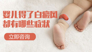 婴幼儿白癜风的初期症状有哪些