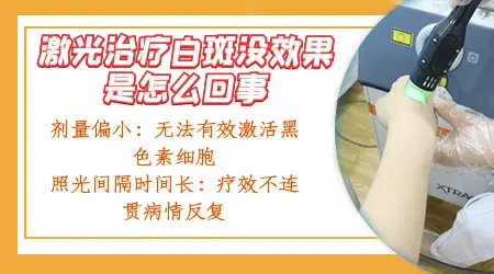 初期白癜风照射308没效果怎么办