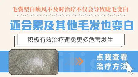 毛囊型白癜风怎么治疗效果比较好