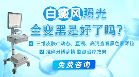 白癜风光疗后皮肤变黑了还能恢复吗