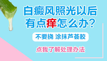 白癜风照了308激光以后有点痒