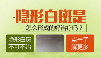 白癜风的隐形白斑症状是什么样