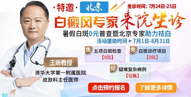 宝宝嘴角一点点白半个月了疑似白癜风做什么检查