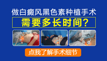 白癜风做种植后皮多长时间能完全脱落