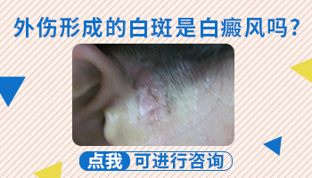 手背受伤后皮肤发白怎么回事