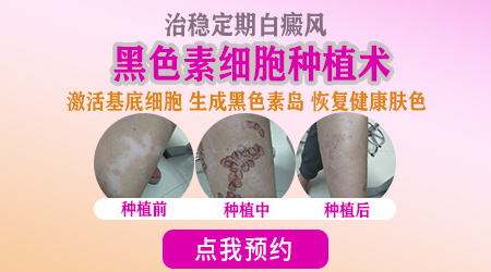 稳定期白癜风移植手术后皮肤图