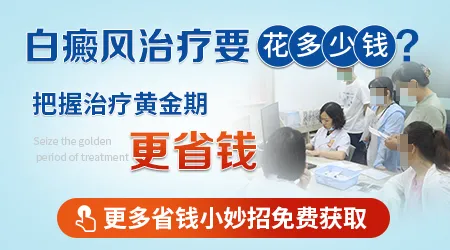 白癜风早期治疗一般需要多少钱