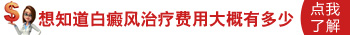 白癜风新农合报销的比例是多少