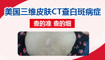 前胸白斑拍打后很白是白癜风吗