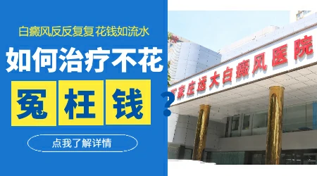 儿童白癜风反反复复怎么办