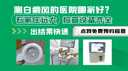 伍德灯检查白斑减号代表什么