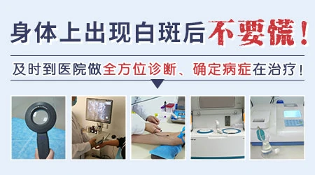 暴晒后脸上突然长白斑是怎么回事