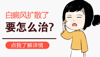 白癜风会扩散到脸上吗
