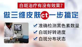 耳后的白斑三个月了还在变大 白斑是什么