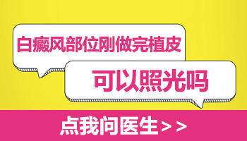 白癜风患者做了植皮手术后需要用其他药品吗